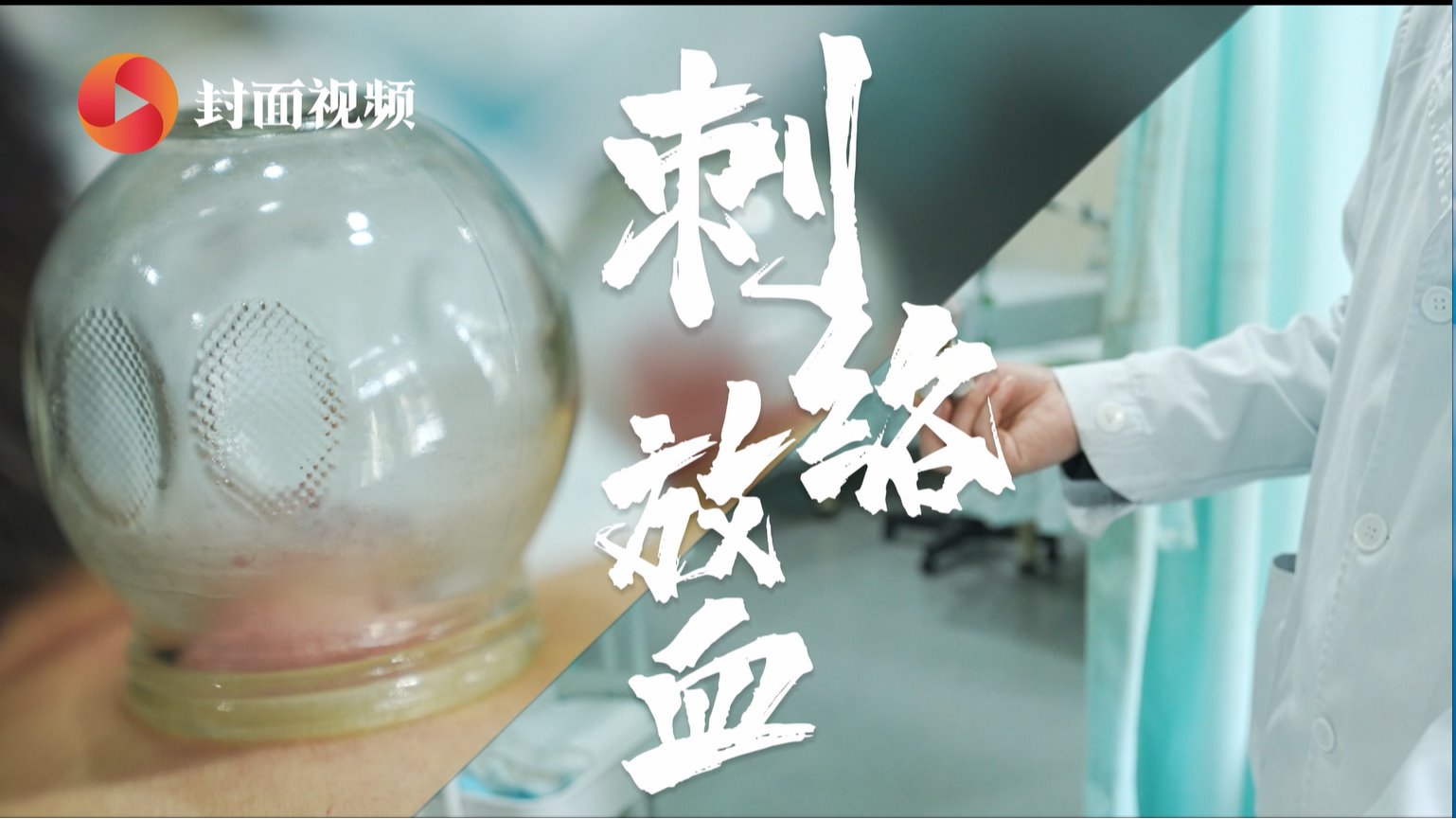 特色療灋(fa)：刺絡放血